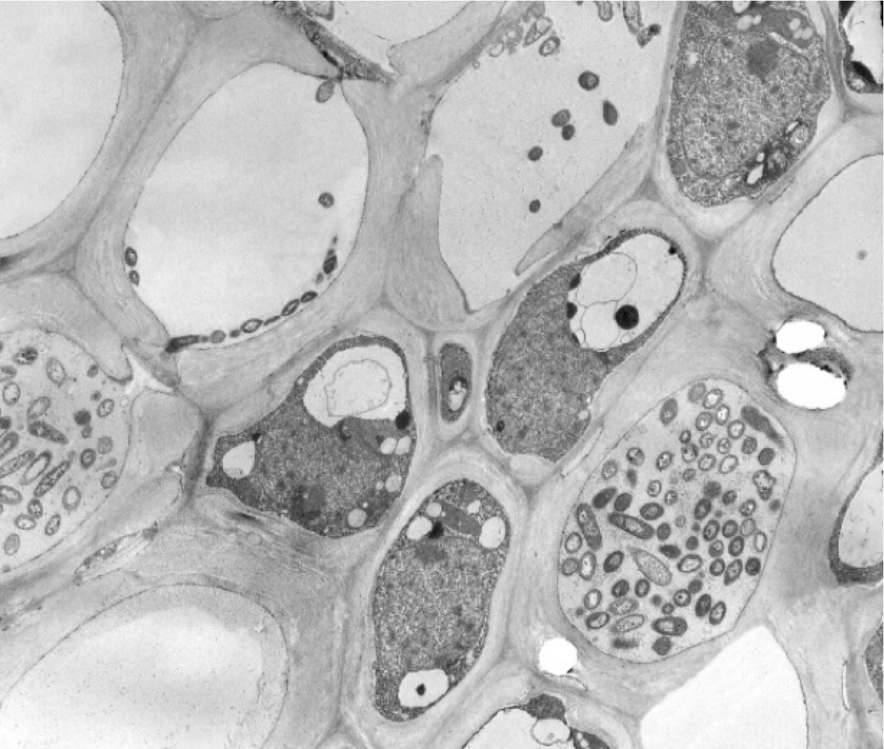 Ingrandimento (8kx) della sezione di un olivo infetto, dov'è evidente la colonizzazione da parte della Xylella fastidiosa.